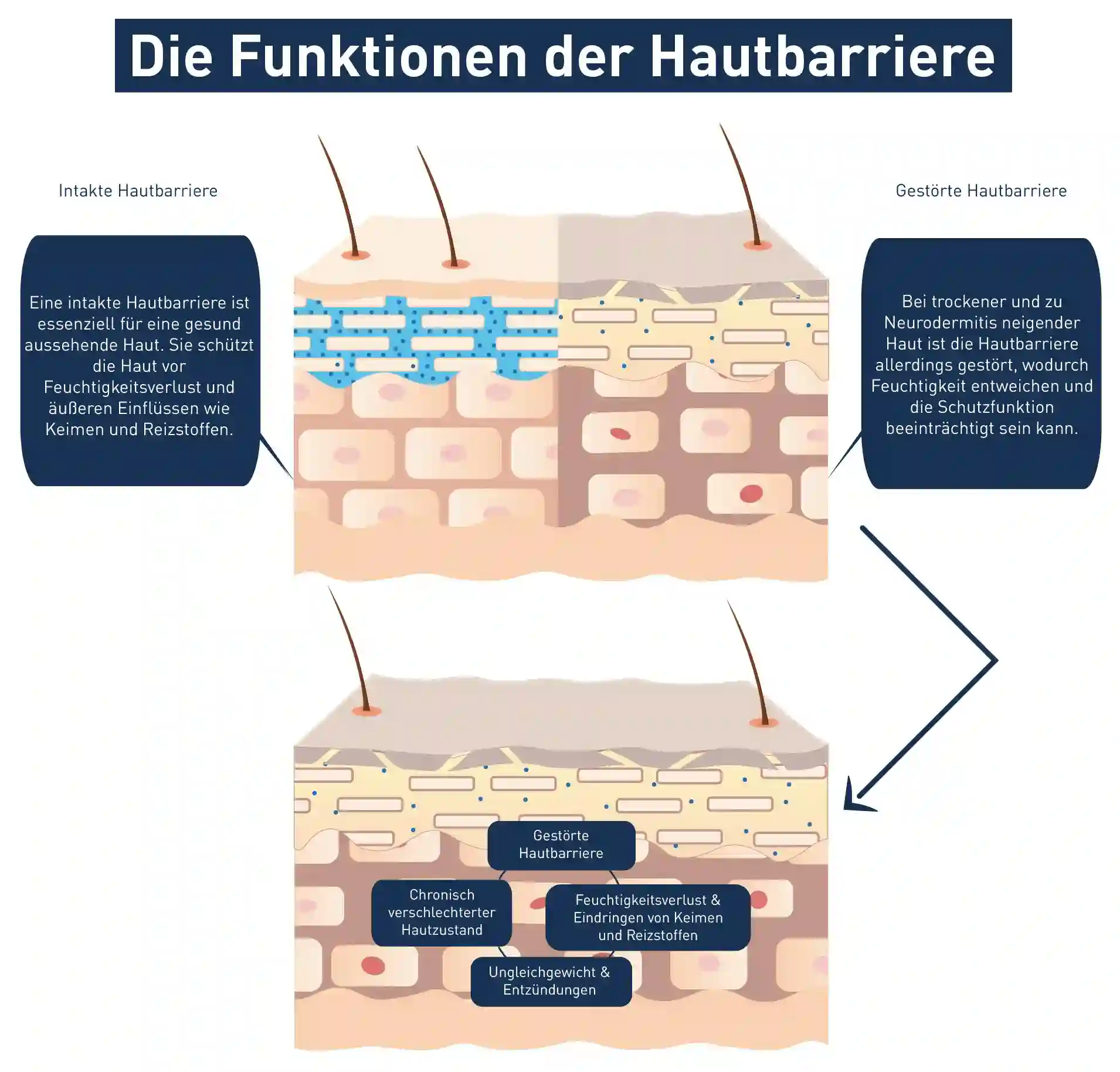 Trockene Haut am Körper: Visuelle Darstellung der Funktion der Hautbarriere